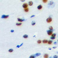 ELK1 Antibody (C-Terminus)
