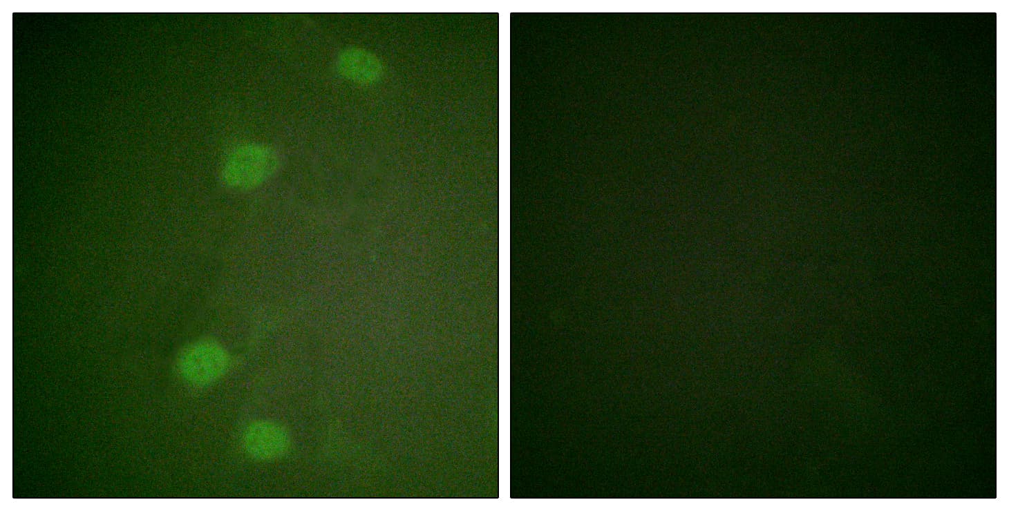 Polyclonal Rabbit anti-Human RB1 / Retinoblastoma / RB Antibody (phospho-Ser249, IF)