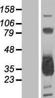 MMACHC Protein (Over-Expression Lysate Myc-DDK (Flag))