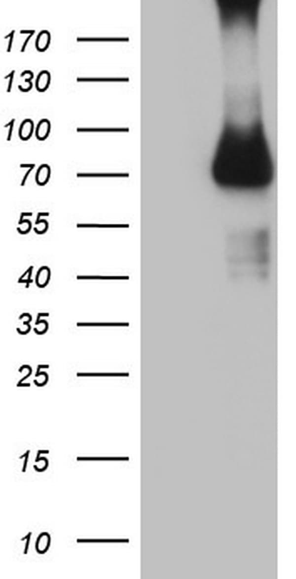 Monoclonal Mouse anti-Human CFI / Complement Factor I Antibody (clone OTI7D6, aa340-583, WB)