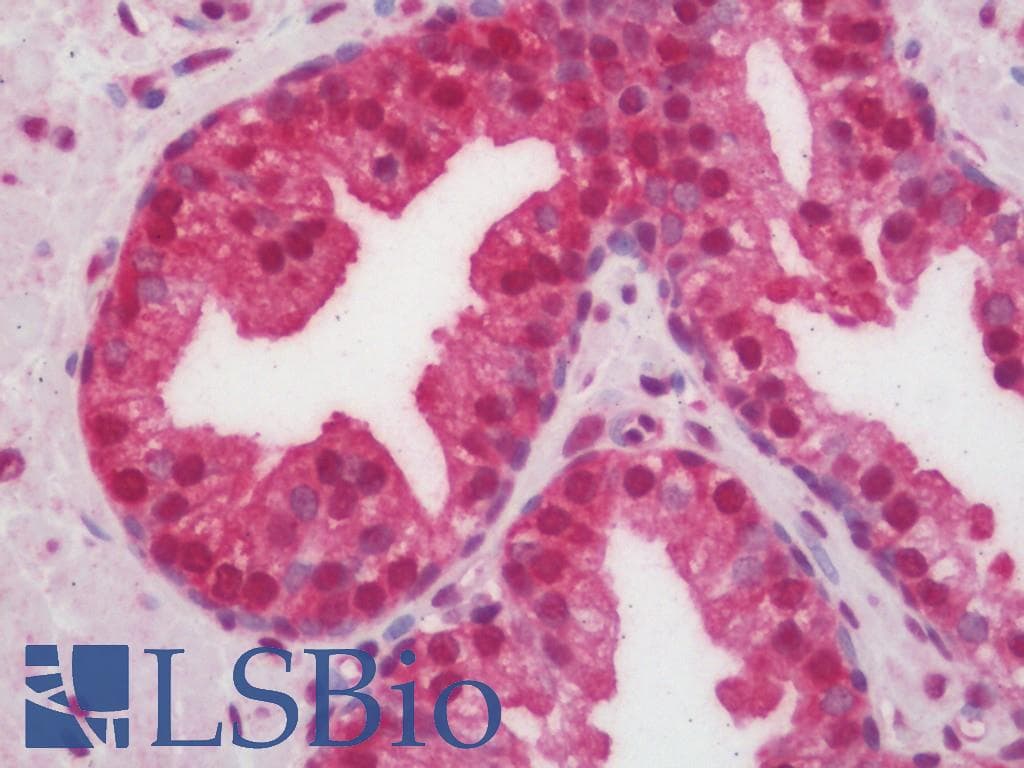 IHC-plus™ Polyclonal Rabbit anti-Human PRKCZ / PKC-Zeta Antibody (aa376-425, IHC, IF, WB)