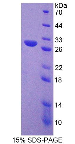 Mouse DGKG Protein (Recombinant His-T7)