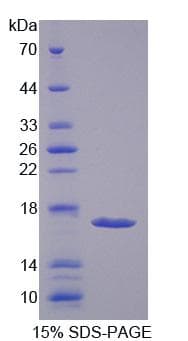 Rat HEXB Protein (Recombinant His-T7)