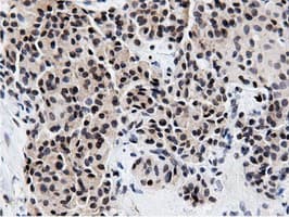 NT5DC1 Antibody (clone OTI3A6)