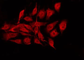 Polyclonal Rabbit anti-Human BCL2 / Bcl-2 Antibody (phospho-Ser70, IHC, IF, WB)