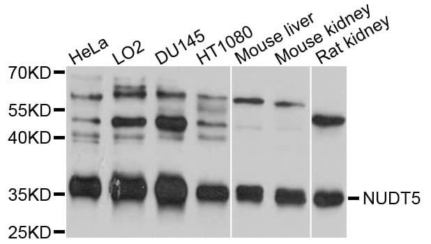 Polyclonal Rabbit anti-Human NUDT5 Antibody (WB)