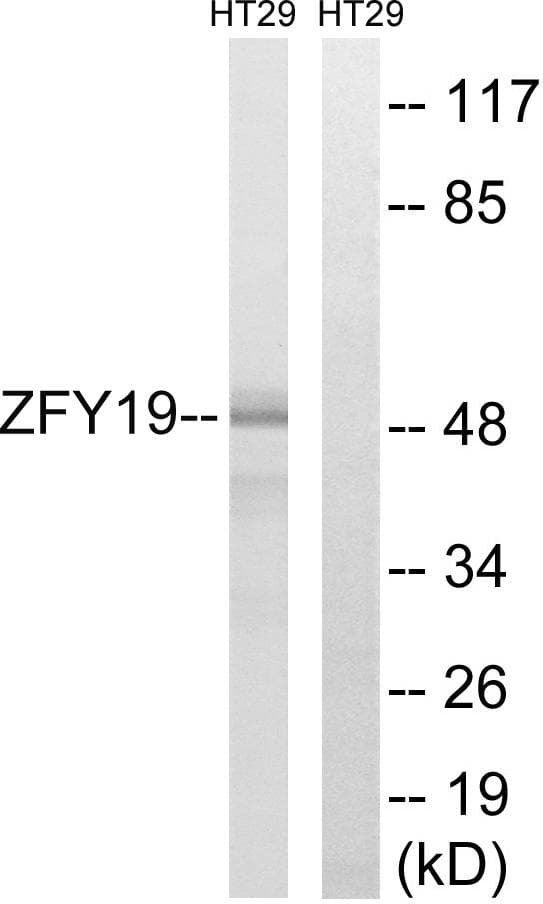 ZFYVE19 Antibody
