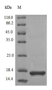 Chicken VP3 / Apoptin Protein (Recombinant 6His, N-terminus)