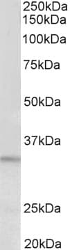 IHC-plus™ PI15 Antibody (aa128-141)