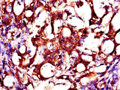 ZMPSTE24 Antibody
