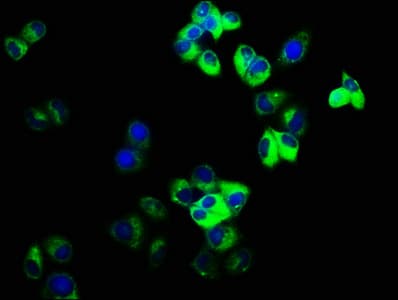 Polyclonal Rabbit anti-Human GJD2 / CX36 / Connexin 36 Antibody (IHC, WB)