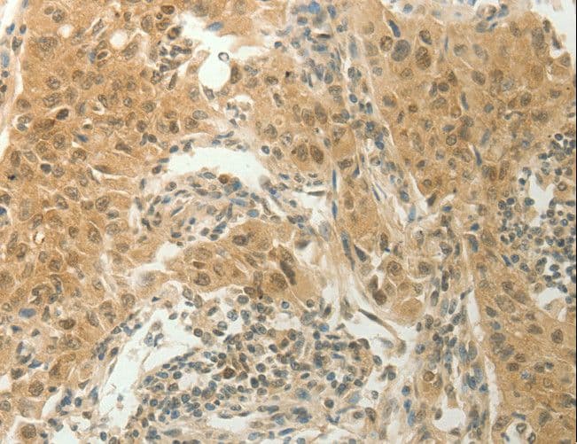 IHC-plus™ SLC8A3 / NCX3 Antibody