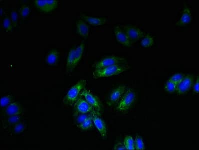 SPTLC3 / C20orf38 Antibody