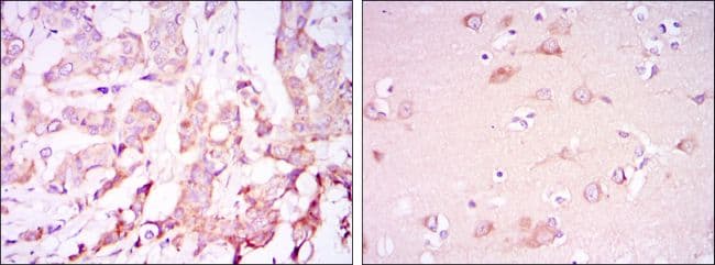 PDK1 Antibody (clone 4A11)