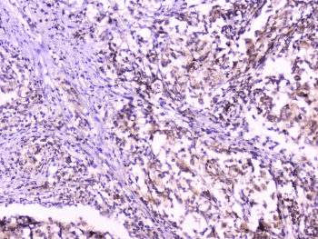 UBE2I / UBC9 Antibody