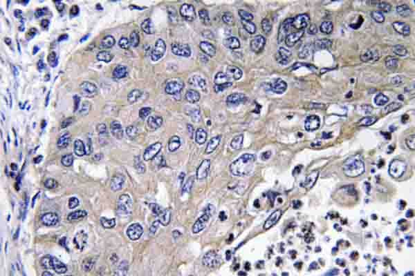CTSD / Cathepsin D Antibody (Lys345)