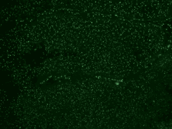 Nuclear Membrane Marker NM97 Antibody (clone NM95, Ready-to-Use)