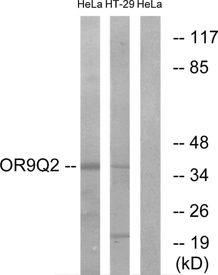 Polyclonal Rabbit anti-Human OR9Q2 Antibody (aa232-281, WB)