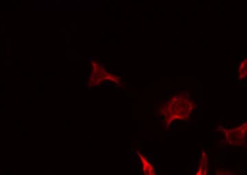 Polyclonal Rabbit anti-Human MER / MERTK Antibody (IF, WB)