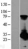 PSME1 Protein (Over-Expression Lysate Myc-DDK (Flag))