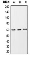 FCAR / CD89 Antibody (Internal)