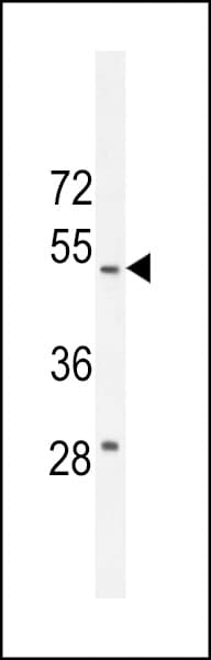 Polyclonal Rabbit anti-Human RTN4IP1 / NIMP Antibody (aa335-363, IHC, WB)