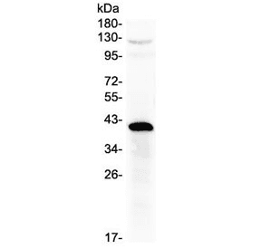 Polyclonal Rabbit anti-Human HSD17 / HSD17B1 Antibody (WB)