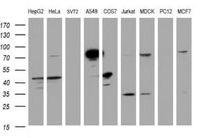 CAPN2 / Calpain 2 / M-Calpain Antibody (clone OTI3G1)