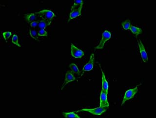 FLT4 / VEGFR3 Antibody