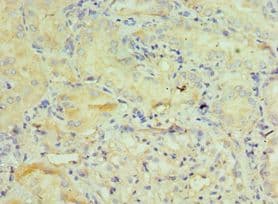 GSTO2 Antibody (aa124-243)