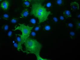 Monoclonal Mouse anti-Human L1CAM Antibody (clone OTI2H6, IHC, IF, WB)