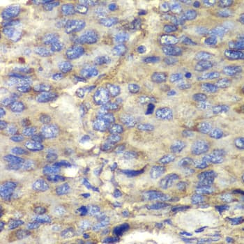 IHC-plus™ SDHA Antibody