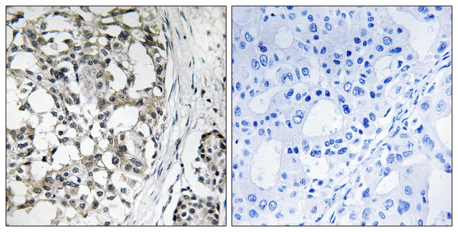 PEX14 Antibody