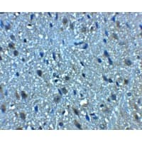 BTF / BCLAF1 Antibody