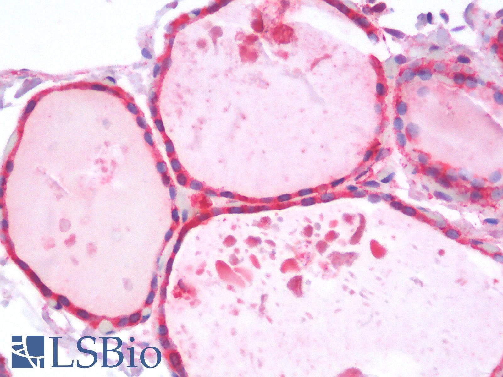 IHC-plus™ HSPA5 / GRP78 / BiP Antibody
