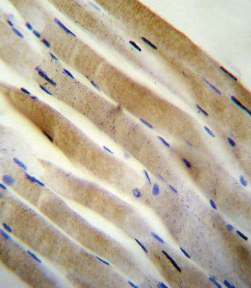 PRKAA2 / AMPK Alpha 2 Antibody (Thr172)