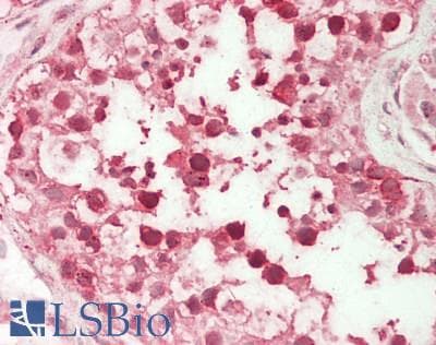 IHC-plus™ UPF3B Antibody (aa433-483)
