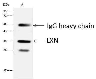 Polyclonal Rabbit anti-Human Latexin / MUM Antibody (Preservative Free, IHC, WB)