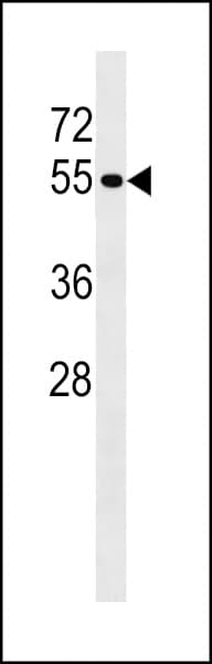 Polyclonal Rabbit anti-Human PTPN18 Antibody (aa430-459, WB)