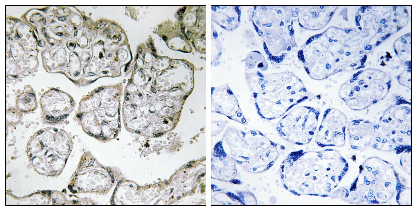 ME2 / Malate Dehydrogenase 2 Antibody