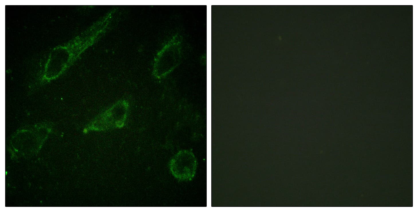ABL1 / c-ABL Antibody (phospho-Tyr245)