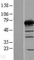 PGM2 Protein (Over-Expression Lysate Myc-DDK (Flag))