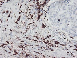 F13A1 / Factor XIIIa Antibody (clone OTI3F1)