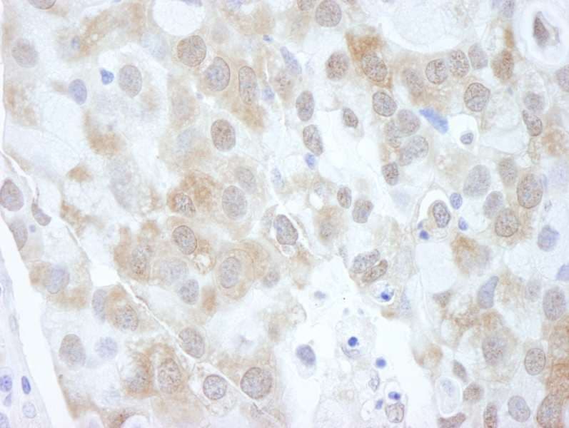 EIF4EBP1 / 4EBP1 Antibody (aa75-C-term)