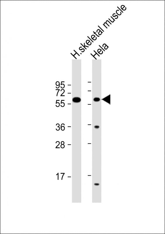 Polyclonal Rabbit anti-Human SLC29A2 / ENT2 Antibody (N-Terminus, IHC, WB)