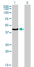 MVD Antibody (clone 2A7)