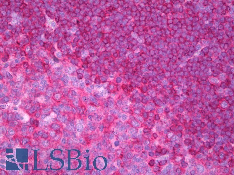 IHC-plus™ CD79B / CD79 Beta Antibody (Intracellular, clone AT107-2)