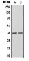 Polyclonal Rabbit anti-Human KLF1 + KLF5 + KLF7 Antibody (C-Terminus, IF, WB)