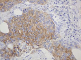 Monoclonal Mouse anti-Human CD99 Antibody (clone OTI13B3, IHC, WB)