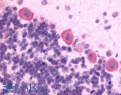 IHC-plus™ OPRK1 / Kappa Opioid Receptor Antibody (C-Terminus)